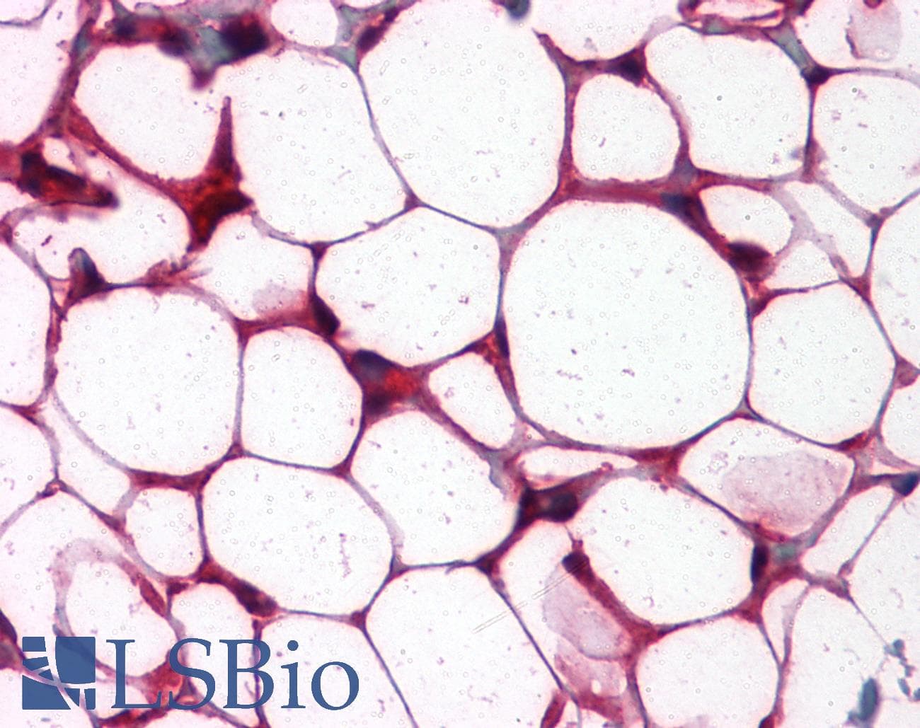 IHC-plus™ ETS1 / ETS-1 Antibody (clone 8A8)