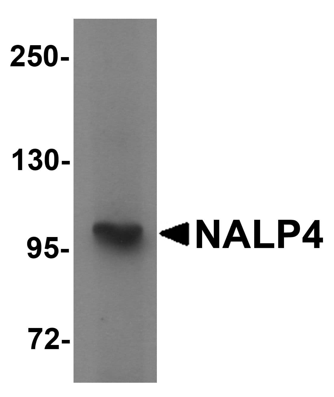 Polyclonal Rabbit anti-Human NALP4 / NLRP4 Antibody (WB)