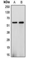 CYP2J2 Antibody (Internal)