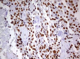 DDX56 Antibody (aa323-547, clone OTI2E5)