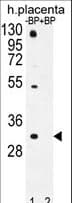 OR1D5 Antibody (aa244-271)