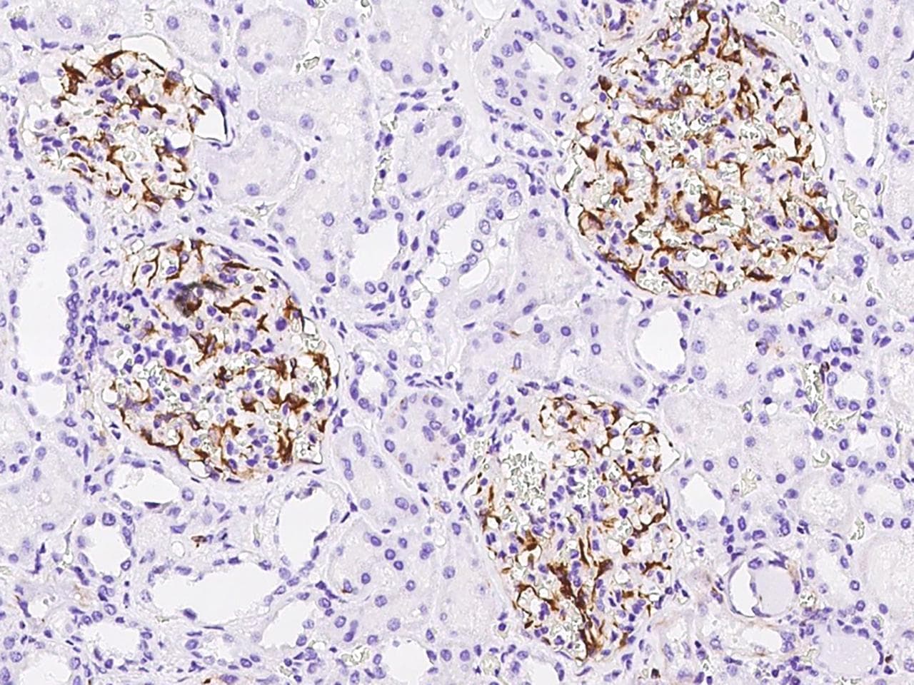 Polyclonal Rabbit anti-Human EDNRA / Endothelin A Receptor Antibody (Preservative Free, IHC)