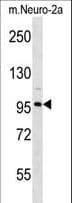CLCN2 Antibody (aa209-237)