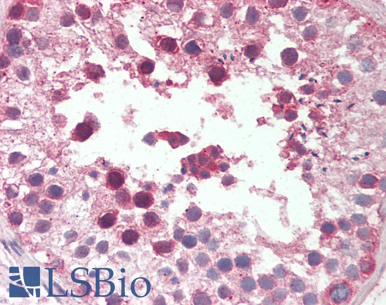 IHC-plus™ Polyclonal Rabbit anti-Human EDC3 Antibody (aa25-75, IHC, WB)