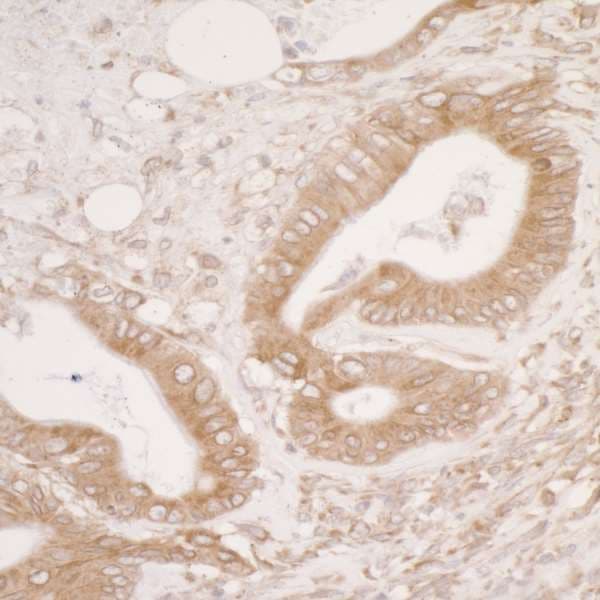 PDIA3 / ERp57 Antibody (aa50-100)