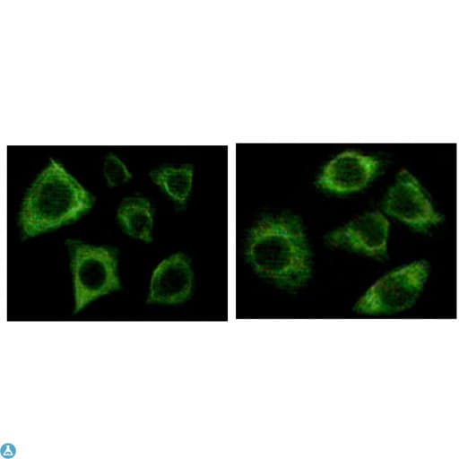 KRT5 / CK5 / Cytokeratin 5 Antibody