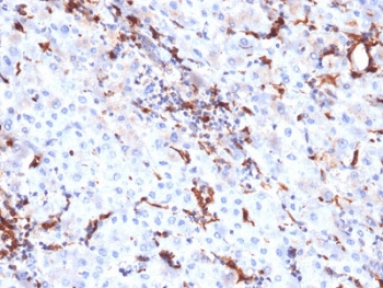 CTSK / Cathepsin K Antibody (clone CTSK/2791, Azide-free, BSA-free)
