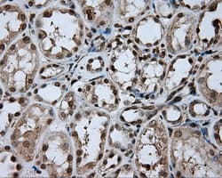 DAPK2 / DAP Kinase 2 Antibody (clone OTI1F7, Carrier-free)