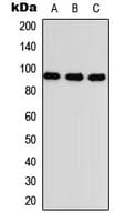 Betaglycan / TGFBR3 Antibody (Internal)