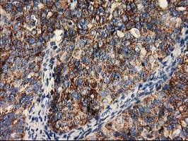 CLPP Antibody (clone OTI1C7)