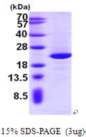 Human NIP7 Protein (Recombinant His)