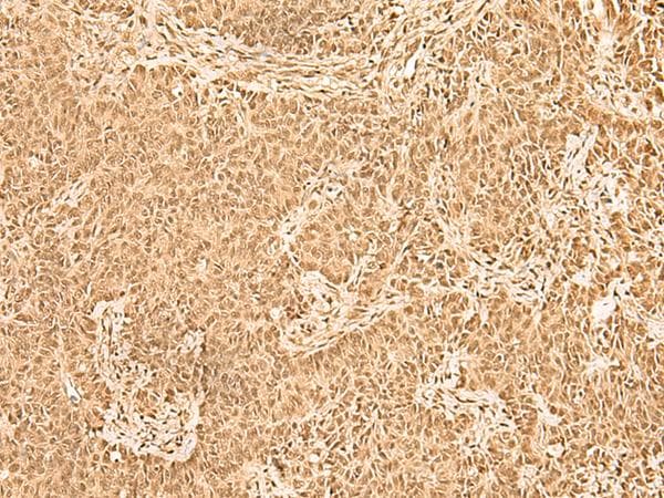 ZNF471 Antibody
