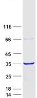 Human CACYBP Protein (Recombinant Myc-DDK (Flag))