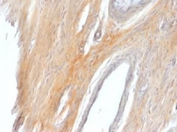 Polyclonal Rabbit anti-Human CALD1 / Caldesmon Antibody (IHC, IF)