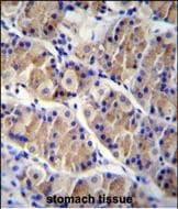 Polyclonal Rabbit anti-Human LRRC38 Antibody (aa 188-216, C-term, IHC, WB)