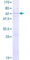 Human ST6GALNAC3 Protein (Recombinant GST)