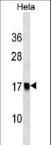 Polyclonal Rabbit anti-Human AP2S1 Antibody (aa36-64, WB)