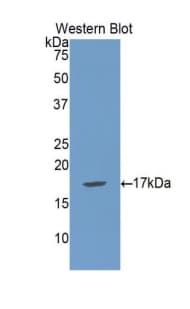 MSMB / MSP Antibody (aa19-114)