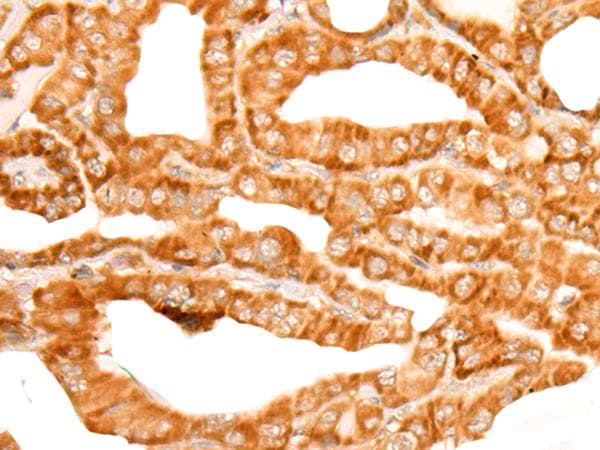 Polyclonal Rabbit anti-Human ZMYND10 Antibody (IHC)