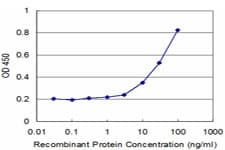 PCGF2 / MEL-18 Antibody (clone 4D6)