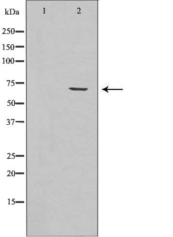 TGFBI Antibody