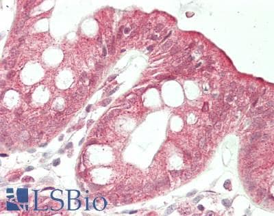 IHC-plus™ NAT1 / AAC1 Antibody