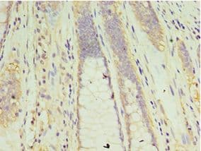 Polyclonal Rabbit anti-Human CLK2 Antibody (aa240-499, IHC)