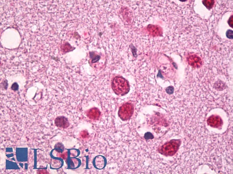 IHC-plus™ Polyclonal Rabbit anti-Human CBX4 Antibody (IHC, WB)