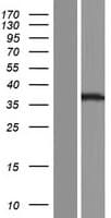 YIF1B Protein (Over-Expression Lysate Myc-DDK (Flag))