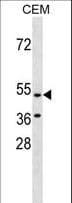 HCAR3 / GPR109B / HM74 Antibody (aa71-99)