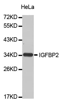 IGFBP2 / IGF-BP53 Antibody