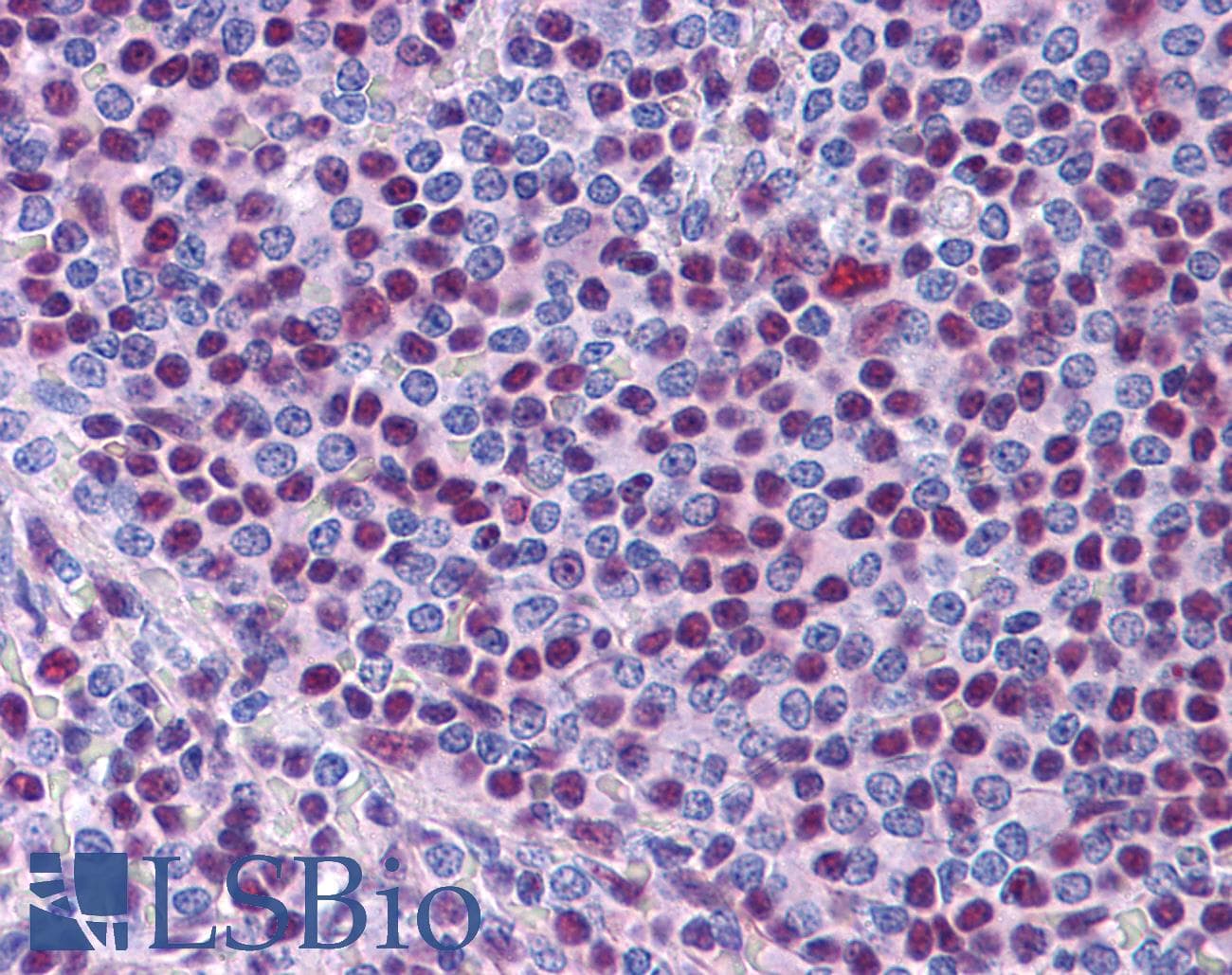 IHC-plus™ NONO / P54NRB Antibody (aa455-467)