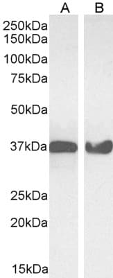 Polyclonal Goat anti-Human GAPDH Antibody (aa92-103, IHC, IF, WB)