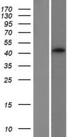 SMS2 / SGMS2 Protein (Over-Expression Lysate Myc-DDK (Flag))
