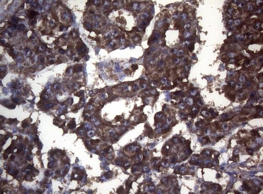 S100A9 / MRP14 Antibody (clone OTI3F8)