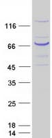 Human PCCA Protein (Recombinant Myc-DDK (Flag))