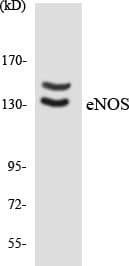 NOS3 / eNOS Antibody (aa1126-1175)