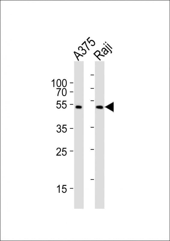 NFKBIE / IKB Epsilon Antibody (aa191-224)