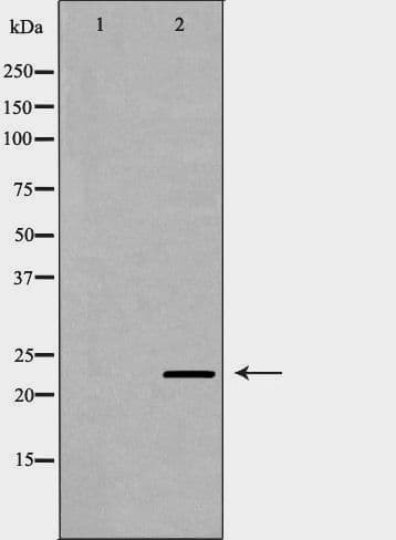PSMB9 Antibody