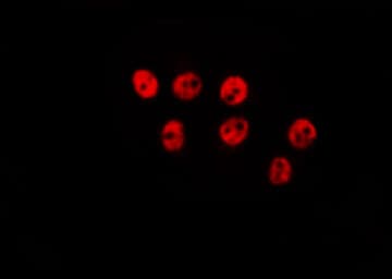 EEYORE / TIGD1 Antibody