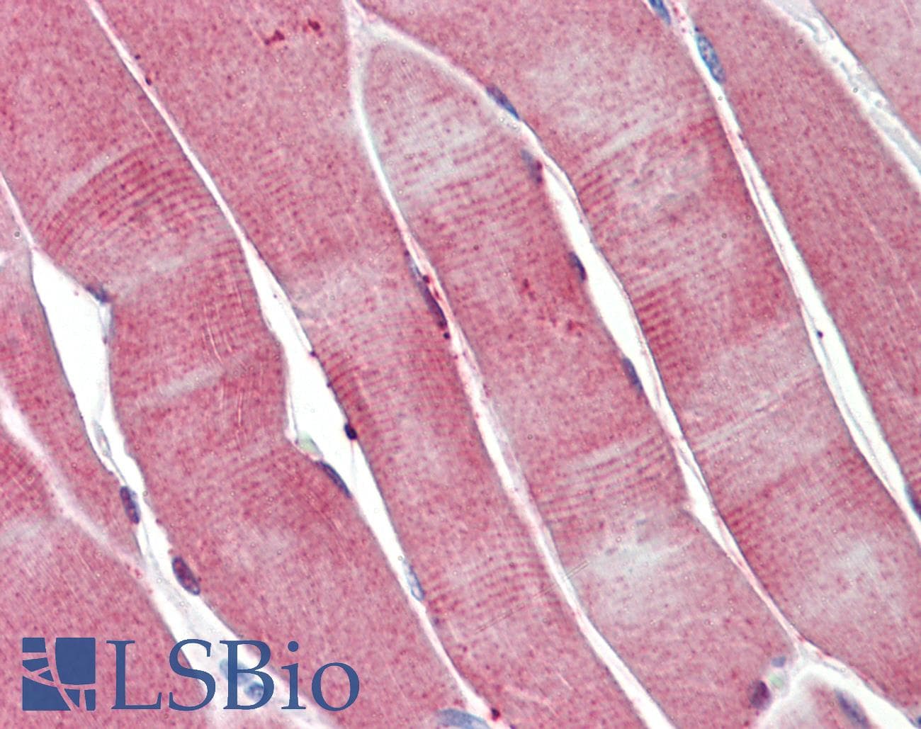 IHC-plus™ PGAM2 Antibody (clone 4E9)