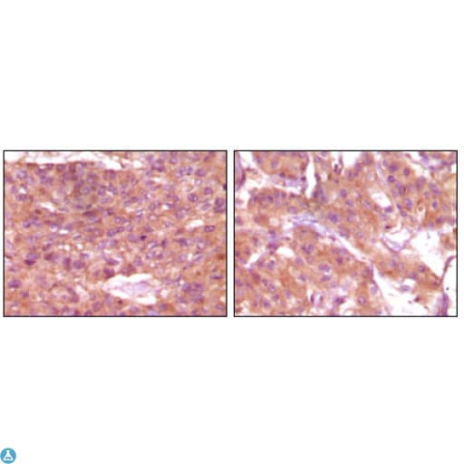 SRA1 / SRA Antibody