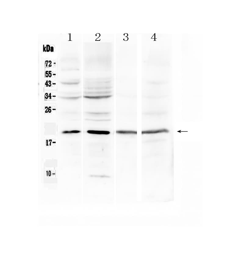 MB / Myoglobin Antibody
