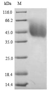 Mouse DLAT / PDC-E2 Protein (Recombinant 6His, N-terminus)