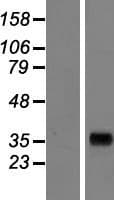 AKR7A3 Protein (Over-Expression Lysate Myc-DDK (Flag))