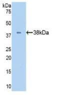 LDHB / Lactate Dehydrogenase B Antibody (aa1-334)