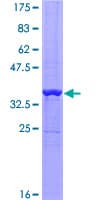 Human PATZ1 / PATZ Protein (Recombinant GST, N-terminus)