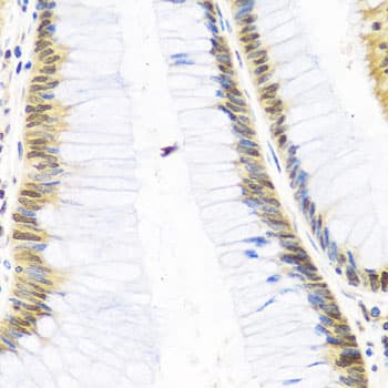 IHC-plus™ Polyclonal Rabbit anti-Human SKIV2L2 Antibody (IHC, WB)