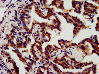 Vps60 / CHMP5 Antibody (aa1-219)