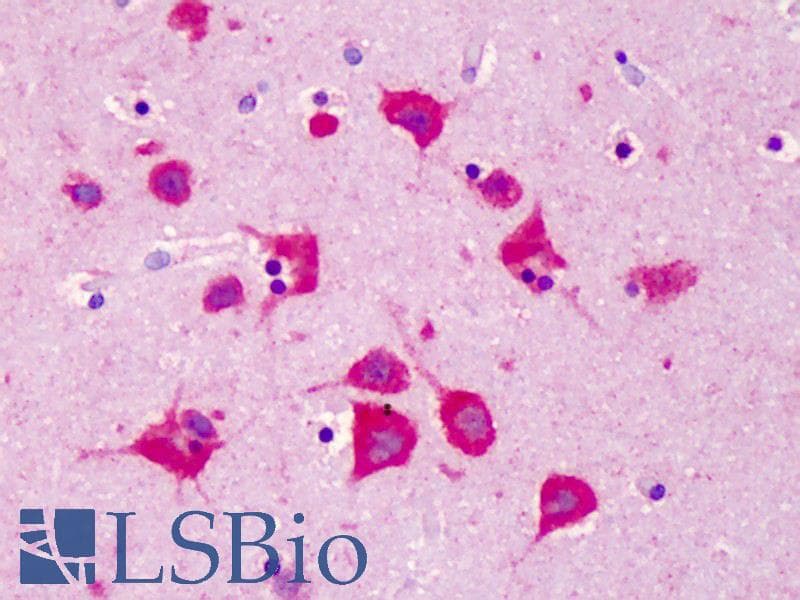 IHC-plus™ Polyclonal Rabbit anti-Human FKBP25 / FKBP3 Antibody (IHC, WB)